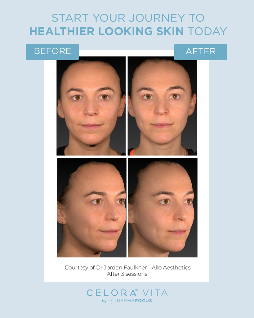 B&A