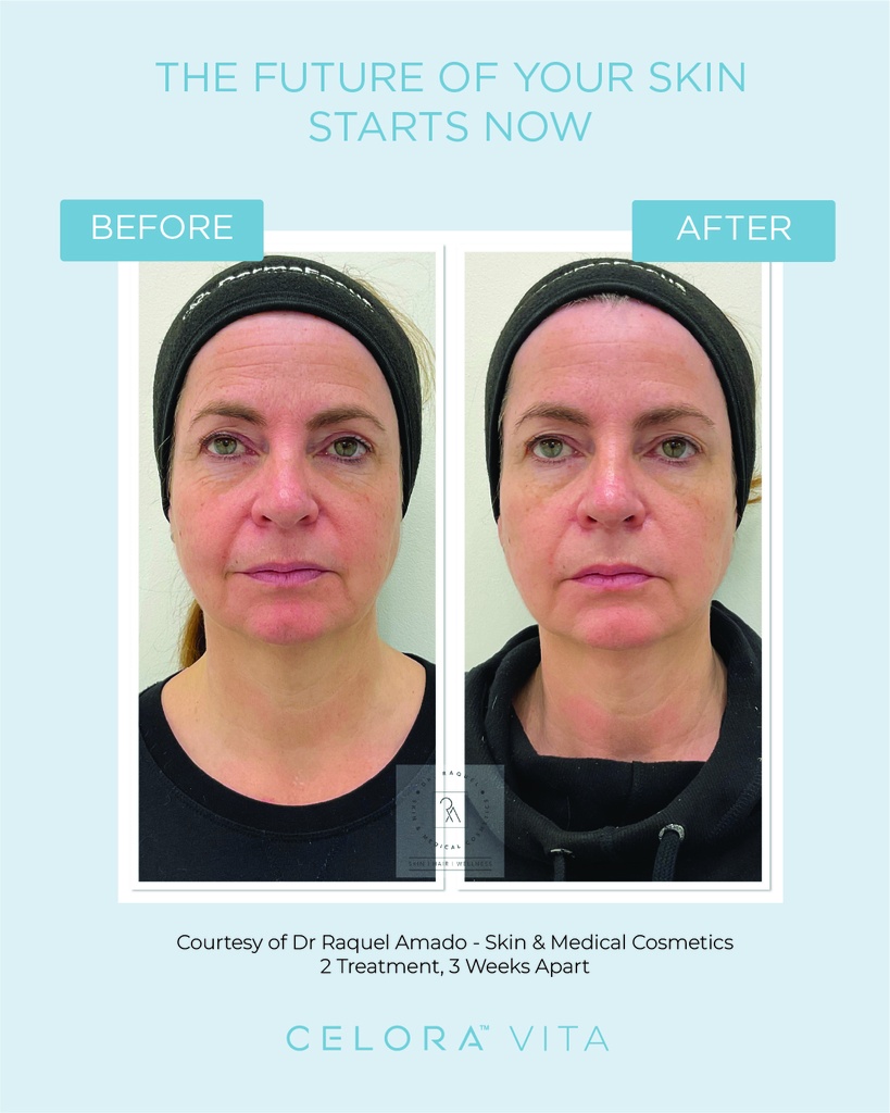 B&A