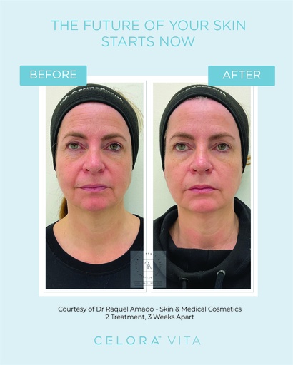 B&A