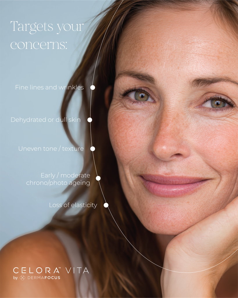 4. The Protein Facial